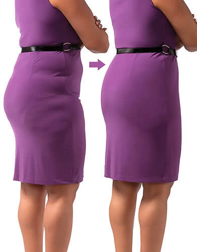 На фотографии изображено сравнение до и вовремя использования корректирующего белья на полной женщине